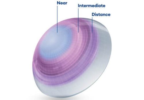 Multifocal Lenses