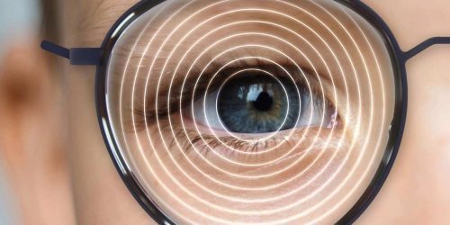 Myopia_control