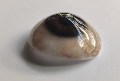 CustomOcularProsthesis