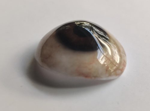 CustomOcularProsthesis