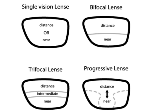 Lenses