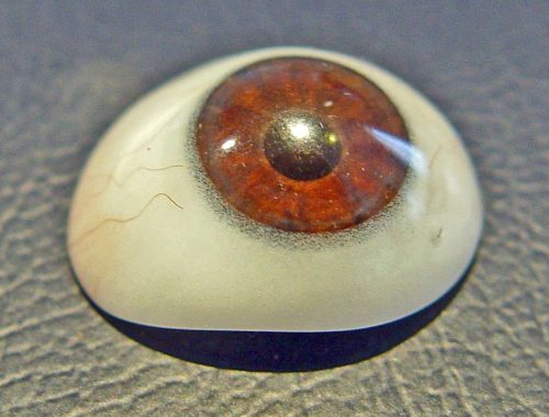Scleral_shell_prosthesis